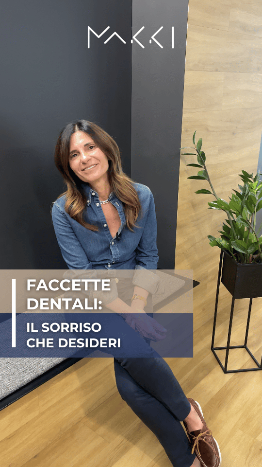 Faccette Dentali