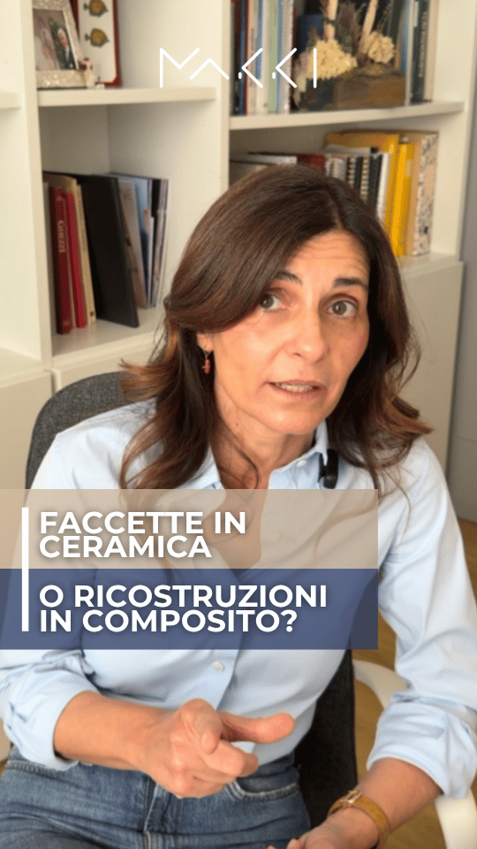 Faccette in ceramica o ricostruzioni in composito